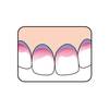 Go to image 2