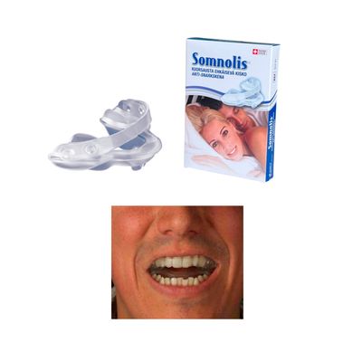 Somnolis suukisko