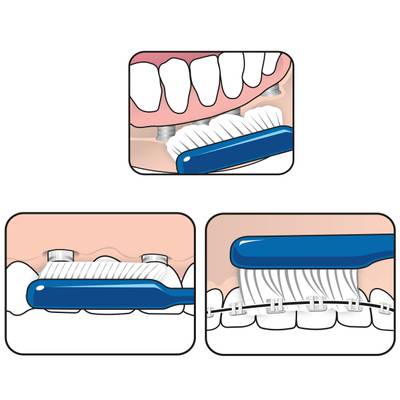 TePe Implant Orthodontic Brush hammasharja